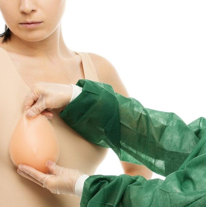 Brustvergrößerungsimplantate