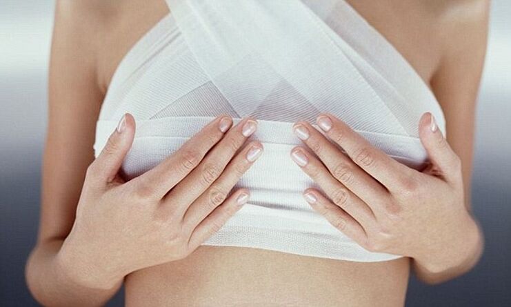 bandagierte Brüste nach einer Brustvergrößerungsoperation
